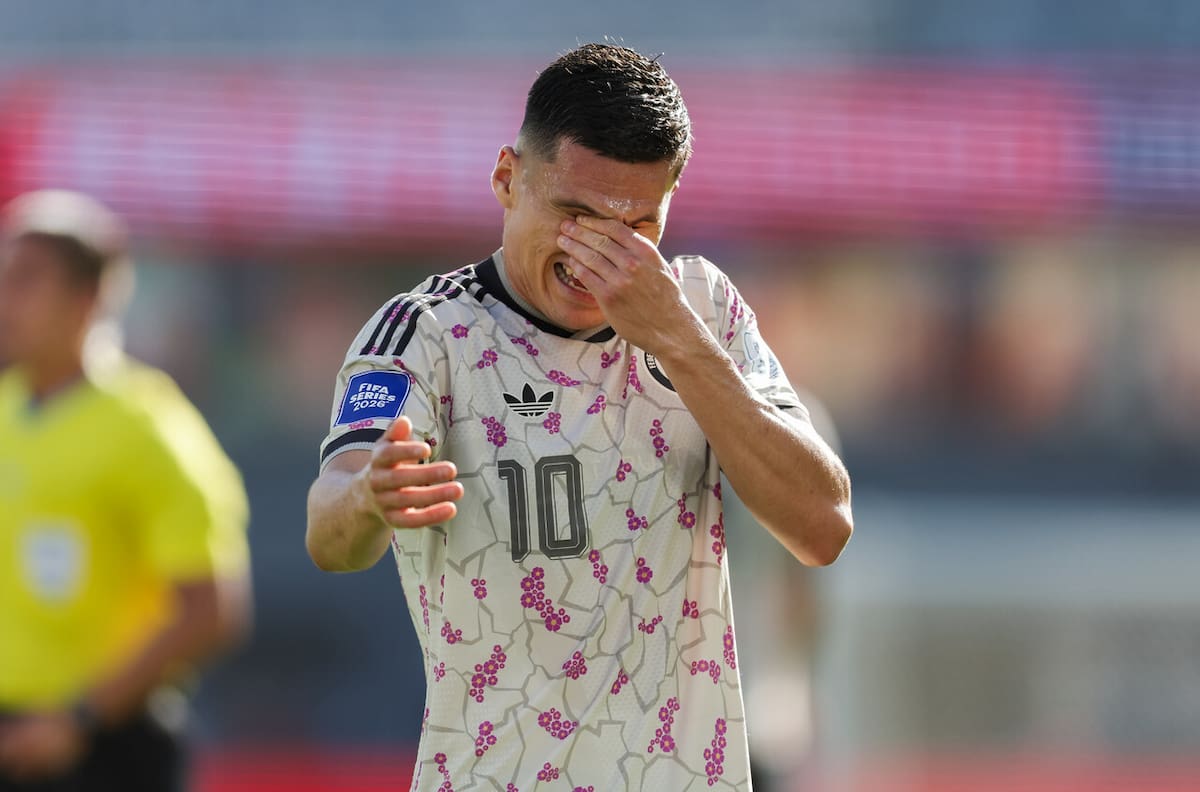 Arturo Vidal sale en defensa de un irreconocible Lucas Cepeda: “Miles de cosas pasan por su cabeza”