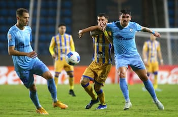 Iquique estalla contra el arbitraje y muestra cómo le quedó la pierna a Luis Casanova