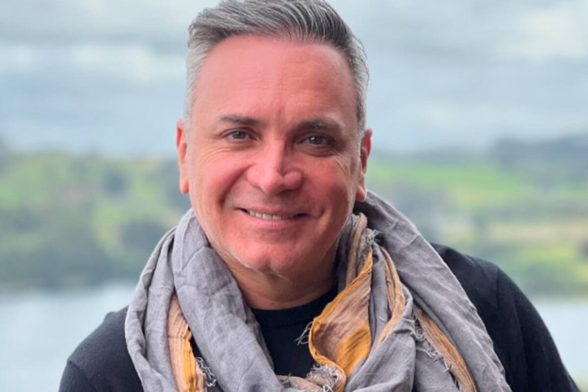 confesó que se implantó pelo. Créditos: Instagram