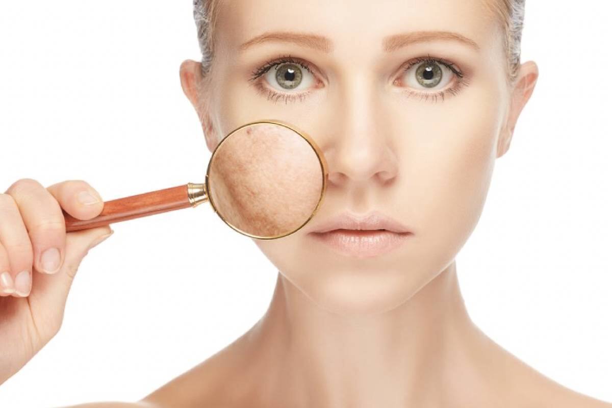 Con estos tips conseguirás eliminar los estragos del sol en tu piel.