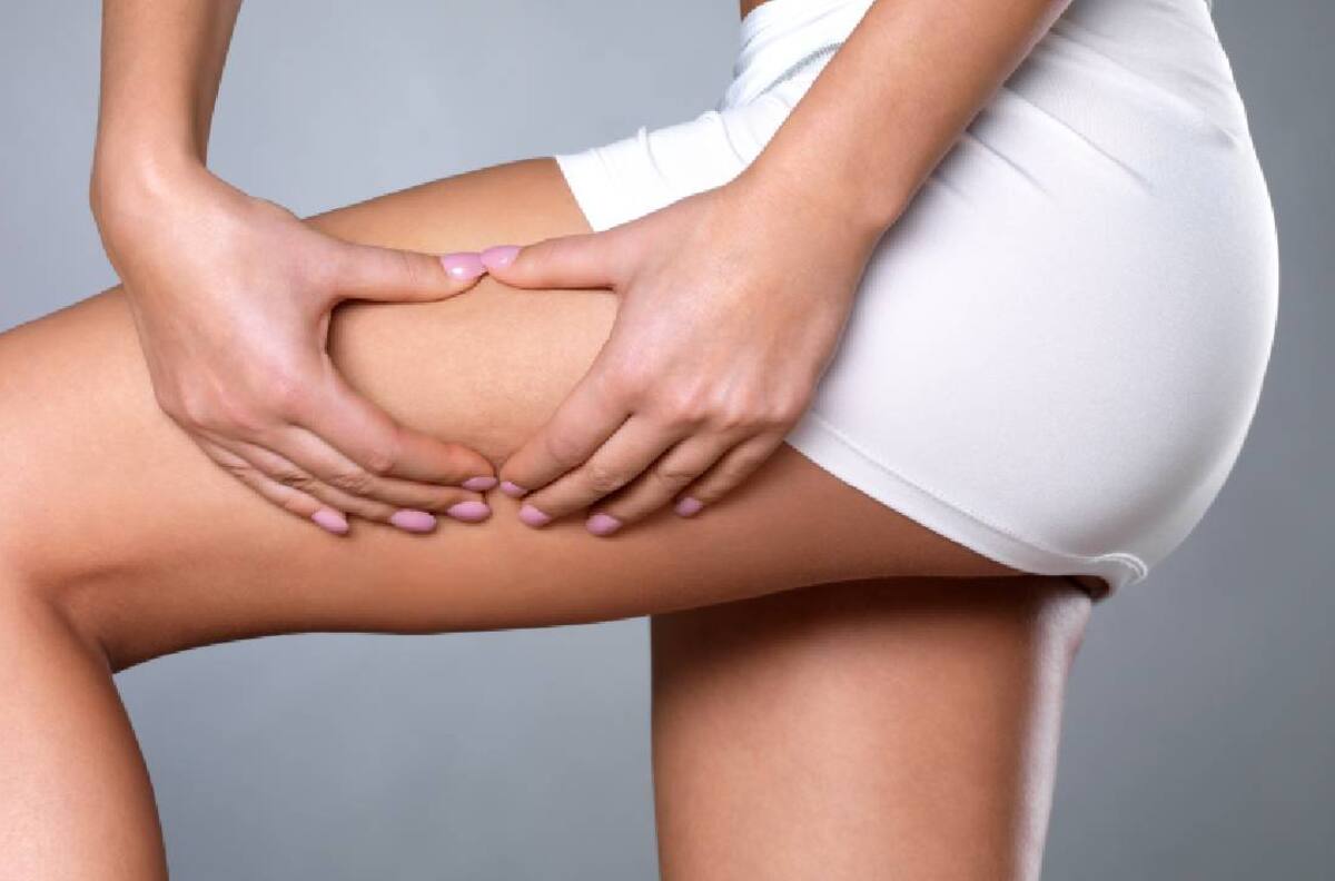 Masajes caseros para reducir la celulitis en las piernas