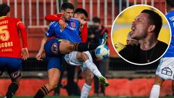 Pinilla no perdona a Di Yorio por su expulsión en victoria de U. de Chile sobre Unión Española