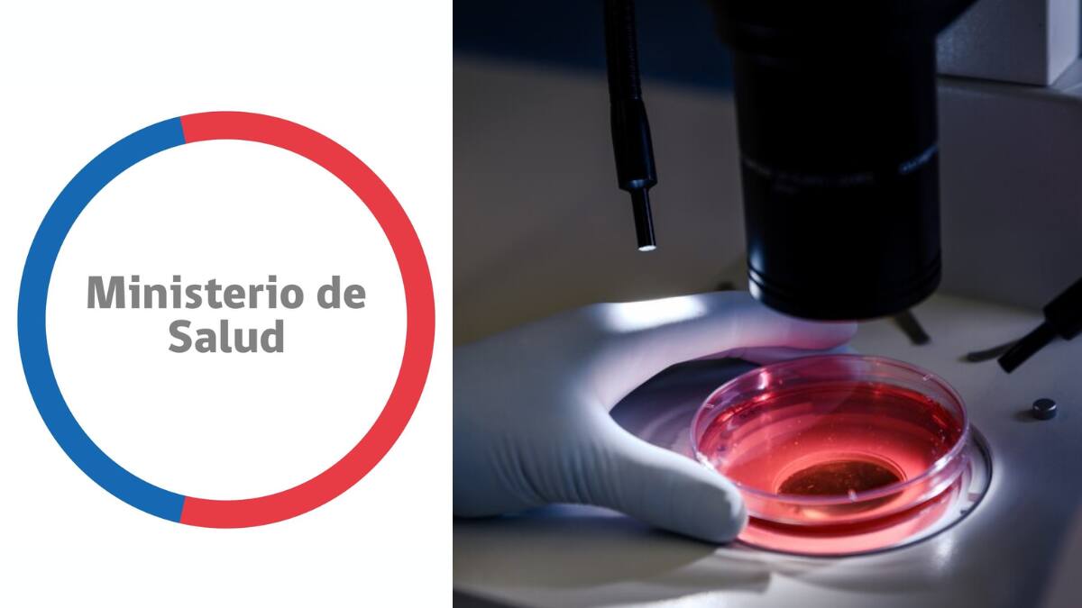 Minsal emite alerta alimentaria por presencia de bacteria en cuatro productos