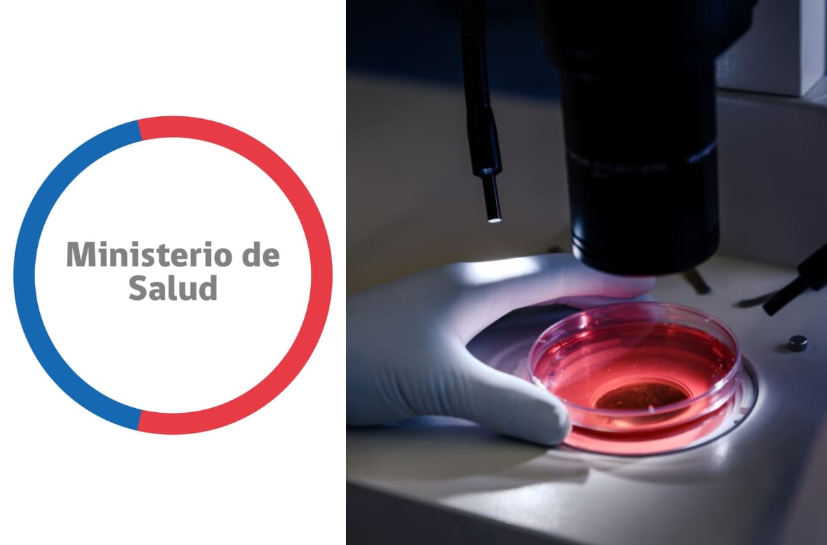 Minsal emite alerta alimentaria por presencia de bacteria en cuatro productos