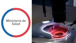 Minsal emite alerta alimentaria por presencia de bacteria en cuatro productos