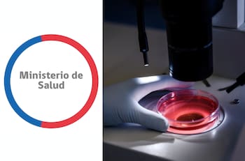 Minsal emite alerta alimentaria por presencia de bacteria en cuatro productos