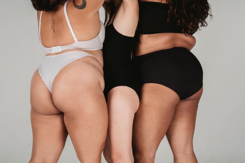 Por años, los cánones sociales han buscado instaurar la delgadez como sinónimo de belleza, mientras que las diversidades corporales son apuntadas como poco saludables.