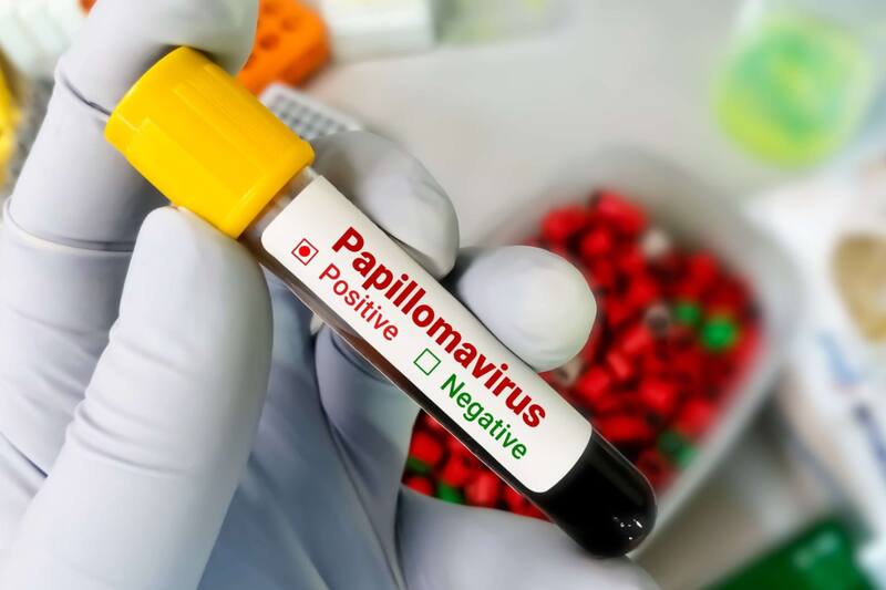 Mujeres podrán acceder a autoexamen de VHP de forma fácil y sencilla.