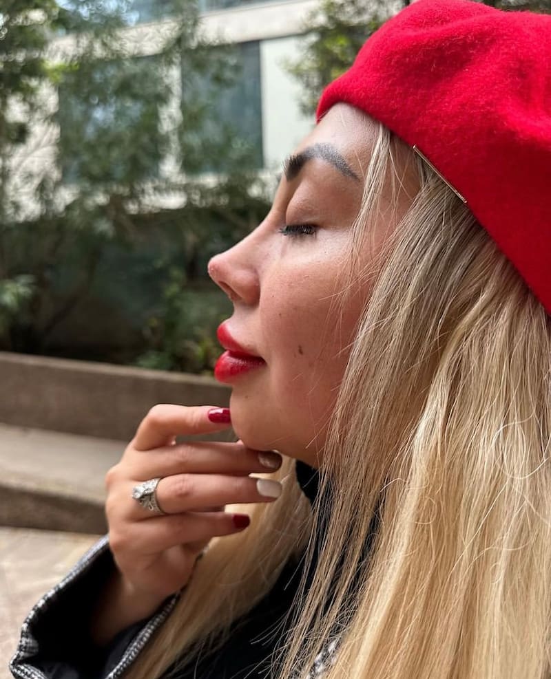 Naya fácil muestra los resultados de su procedimiento estético. Foto: Instagram.
