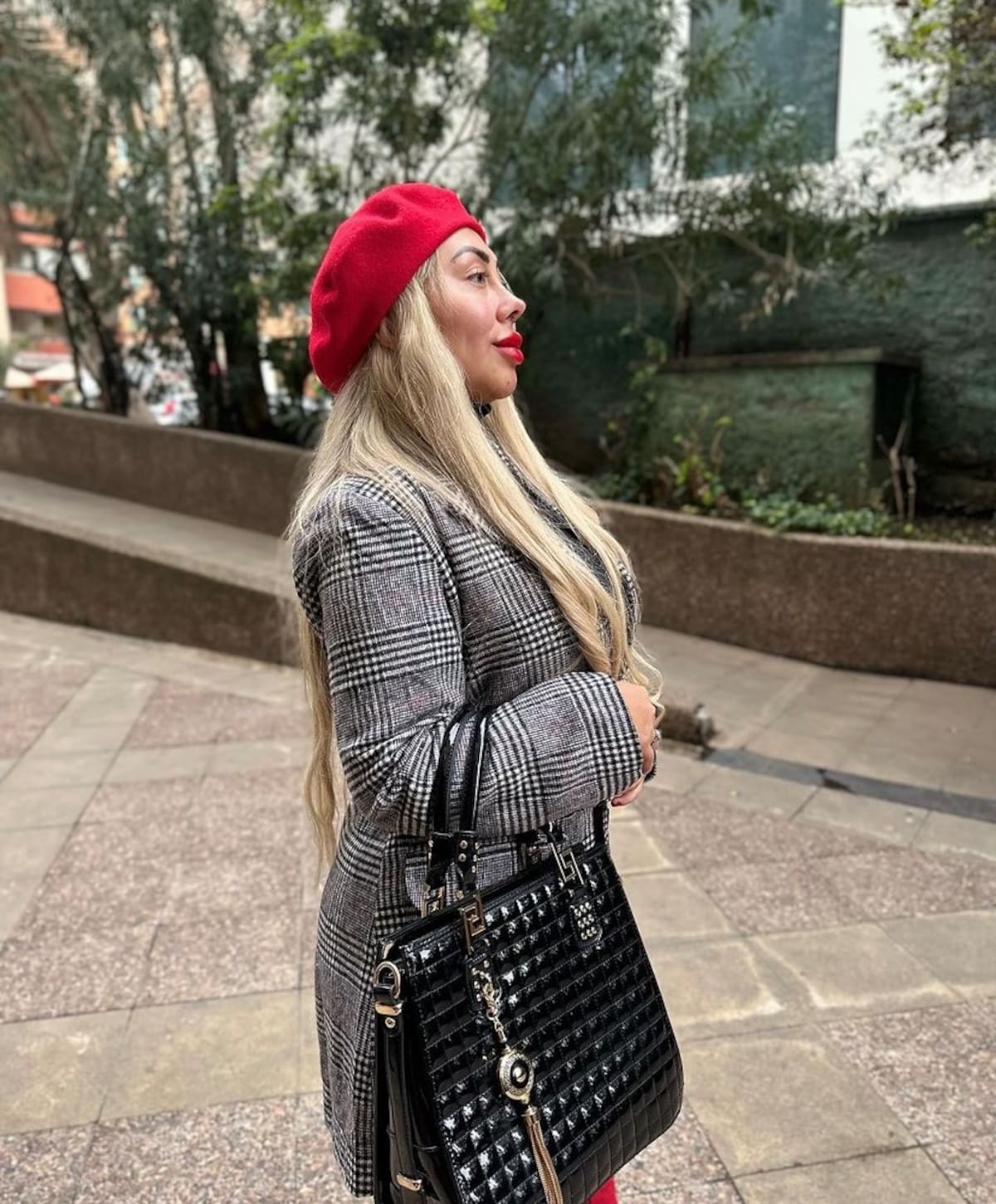 Naya fácil comparte los resultados de su procedimiento estético. Foto: Instagram.