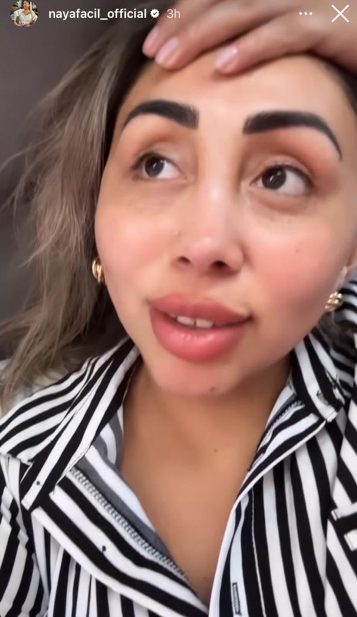 La influencer cuenta detalles de su operación.