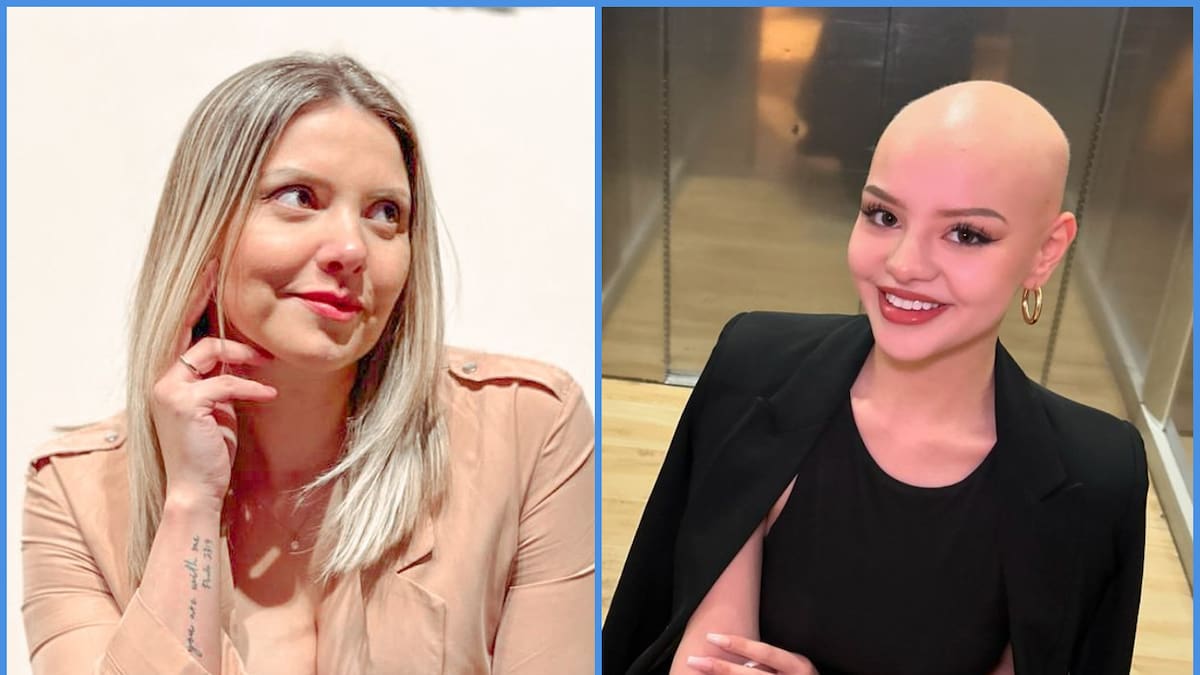 Hija de Nicole Pérez, ex “Mekano”, se postula a Miss Chile tras superar alopecia y una dura adolescencia
