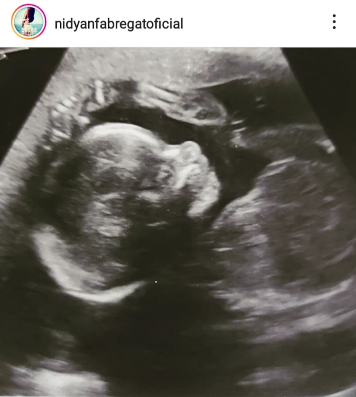 Créditos: Instagram