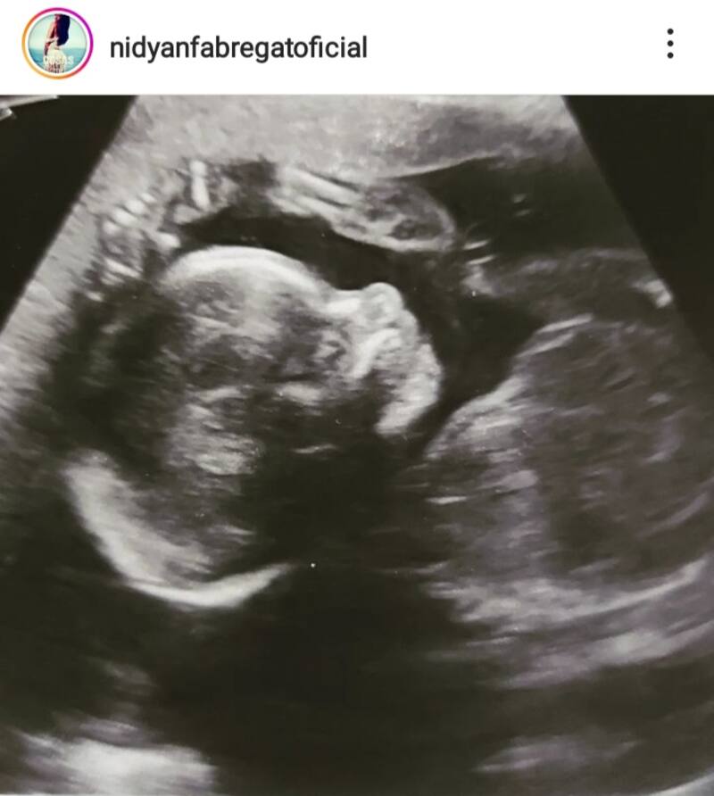 Créditos: Instagram