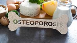 Alimentos que recomienda Harvard consumir a diario para fortalecer los huesos y evitar enfermedades relacionadas