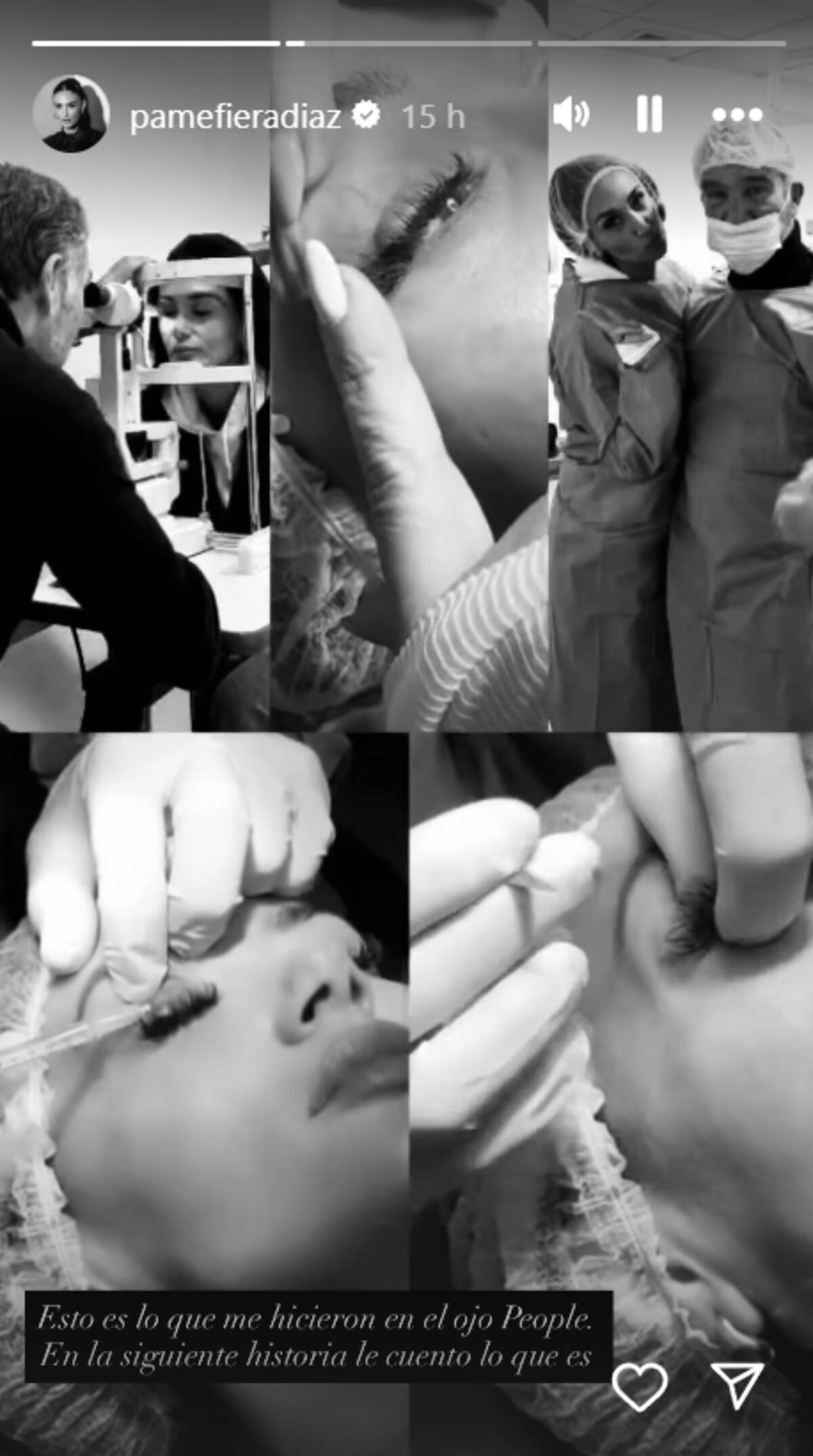 A la fiera le extrajeron quirúrgicamente la protuberancia en su párpado.