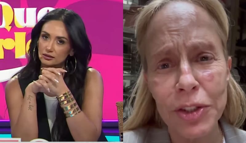 y su opinión sin filtro sobre la baja de Cecilia Bolocco en la Teletón 2024.