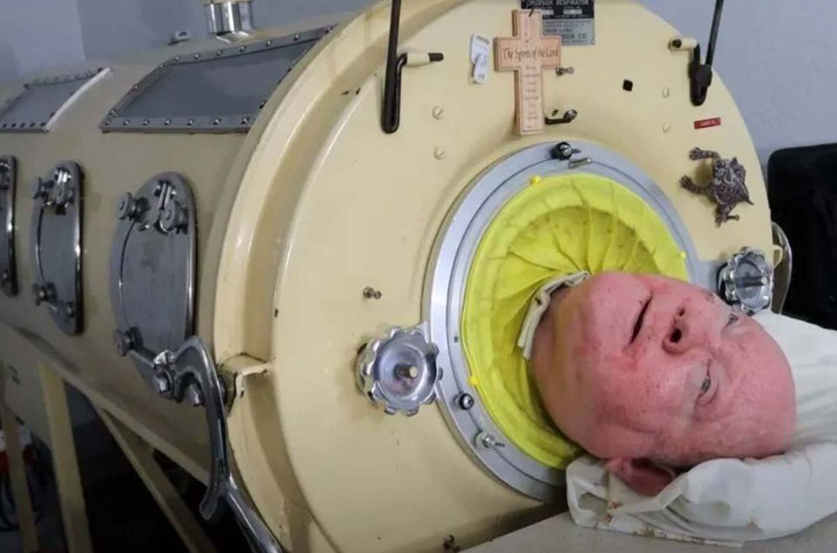 Paul Alexander: Muere a sus 78 años el hombre que vivió siete décadas dentro de una cápsula