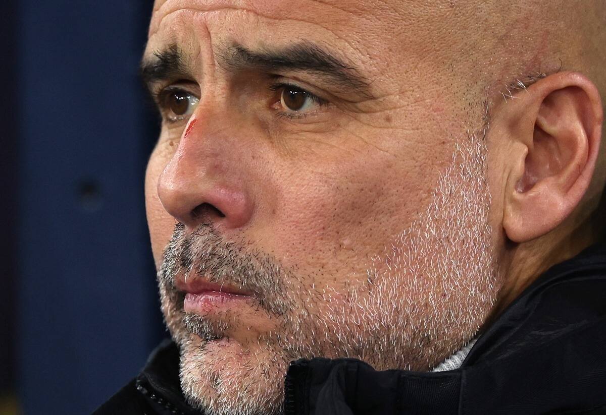 apareció con heridas tras el empate ante el Feyenoord.
