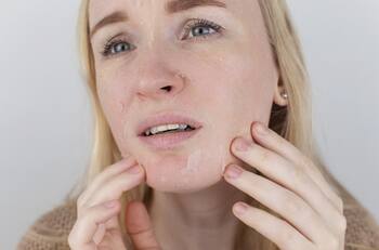 Clínica Alemana entrega CUATRO consejos para combatir la resequedad de la piel