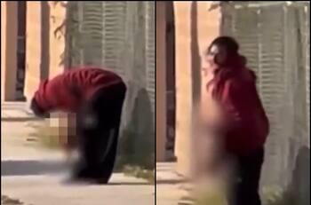 Impactante: Graban a hombre mordiendo una cercenada pierna humana en las calles de California