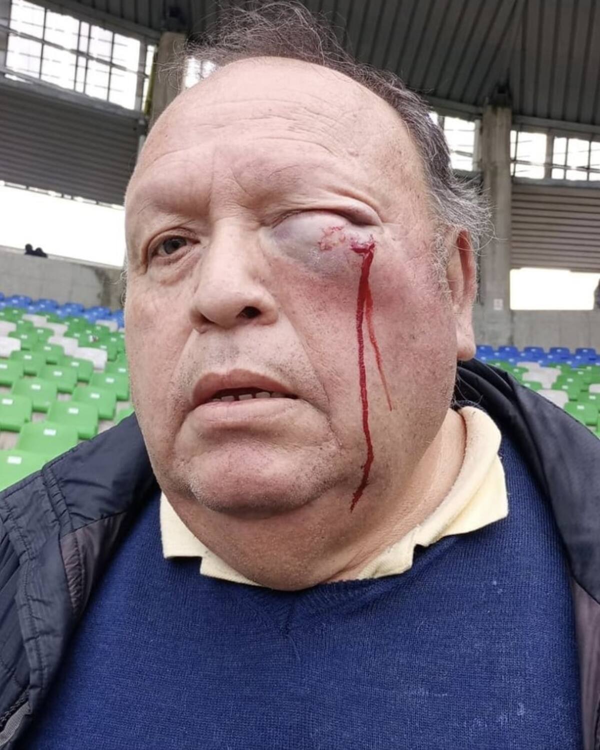 Así quedó el hincha agredido por Mauricio Viana.