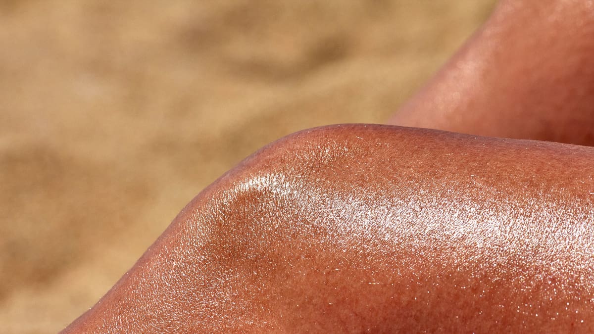 Clínica Mayo entrega consejos clave para cuidar las quemaduras por el sol en casa