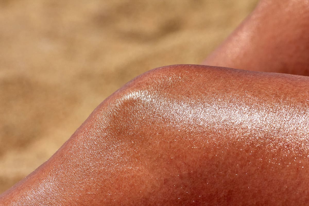 Pasar prolongadas horas bajo el sol sin los cuidados necesarios puede generar lesiones de diversa gravedad. Créditos: Unsplash.