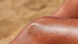 Clínica Mayo entrega consejos clave para cuidar las quemaduras por el sol en casa