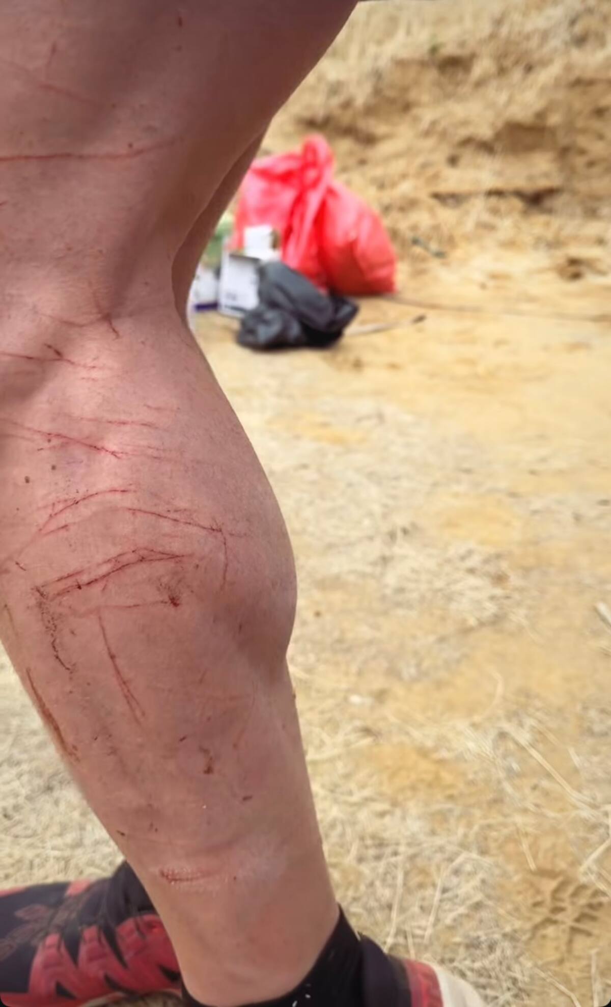 El influencer mostró impactantes lesiones en la semifinal de Palabra de Honor.