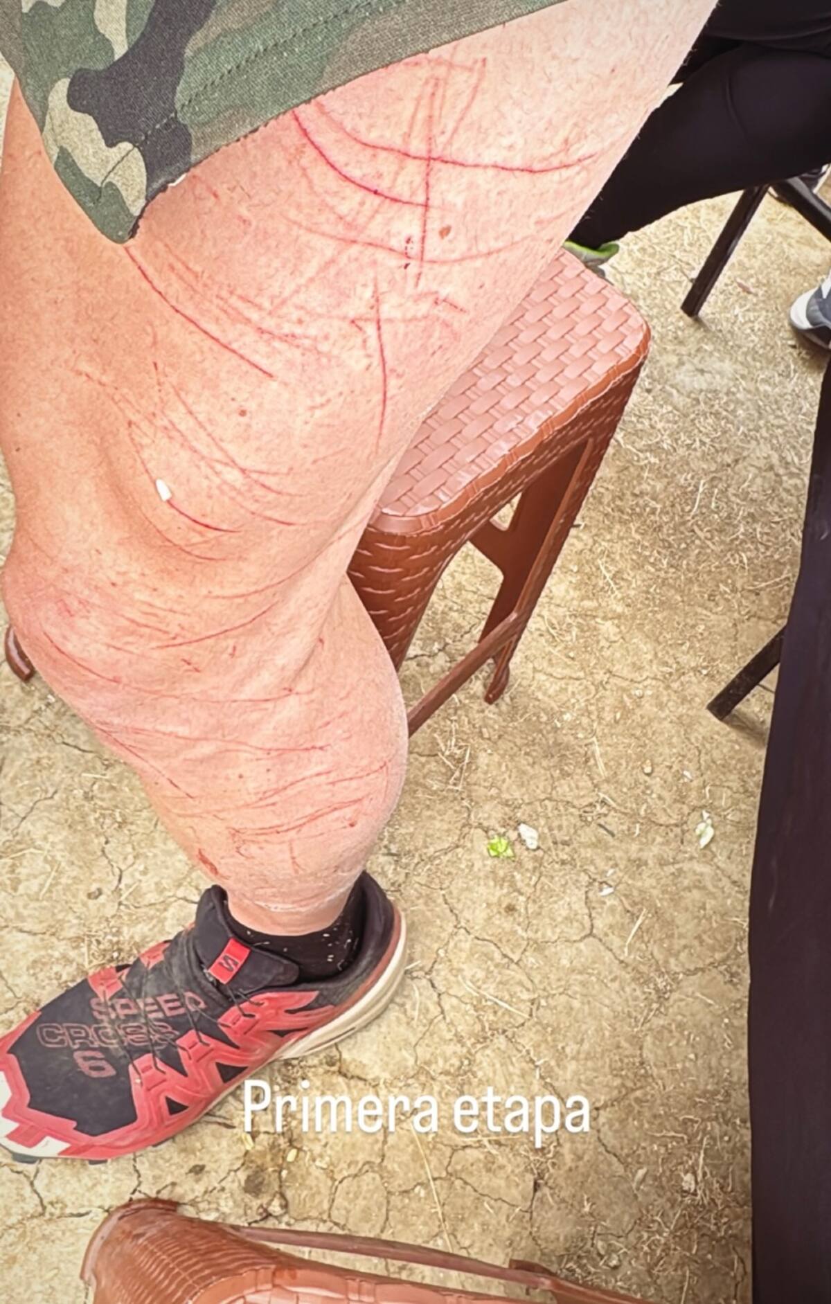 El influencer mostró impactantes lesiones en la semifinal de Palabra de Honor.