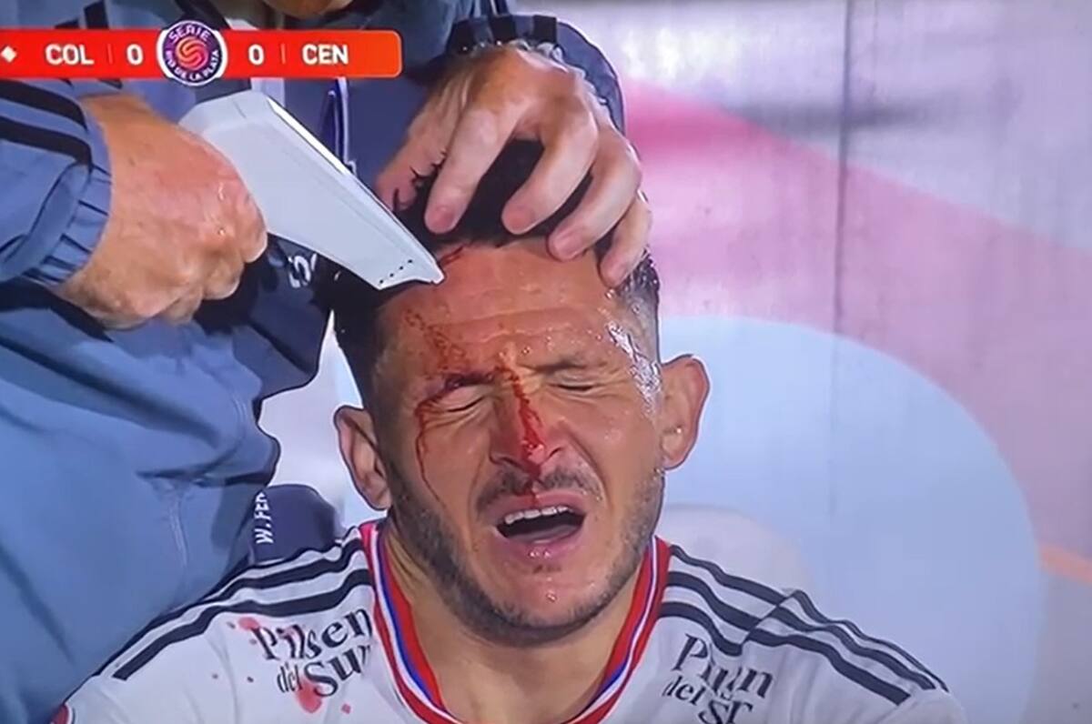 sufrió un profundo corte en la frente en el amistoso con Rosario Central.