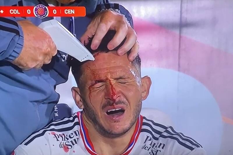 sufrió un profundo corte en la frente en el amistoso con Rosario Central.