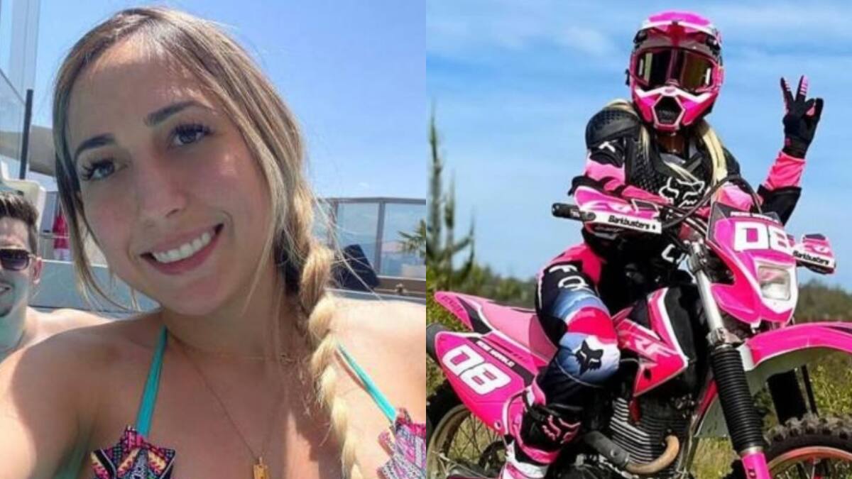 Rebeca Naranjo, pareja de Nano Calderón, mostró cómo quedó su rostro tras grave accidente en moto