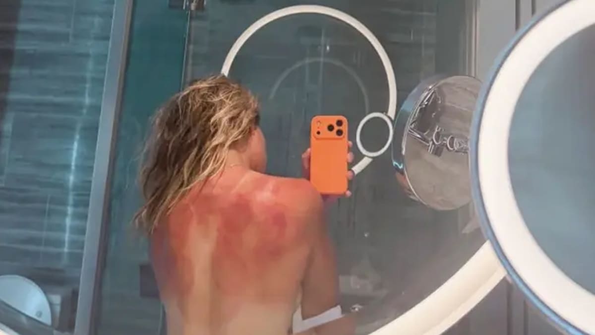 Tenista mexicana se desnuda para mostrar los efectos del sol en Australia: “No es chiste”