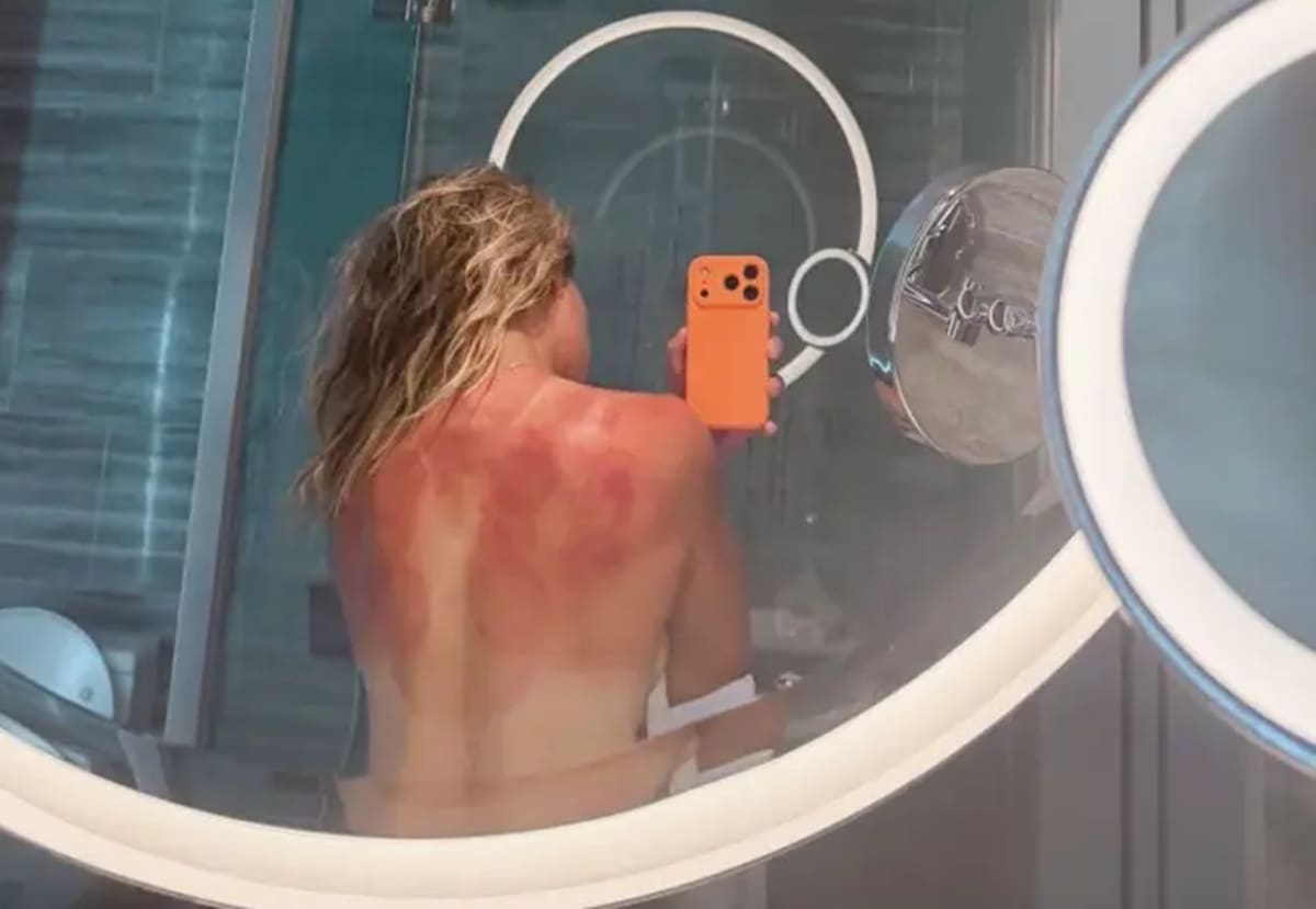 La tenista mexicana mostró los efectos del sol australiano. Foto: Instagram