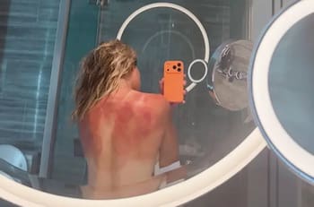 Tenista mexicana se desnuda para mostrar los efectos del sol en Australia: “No es chiste”