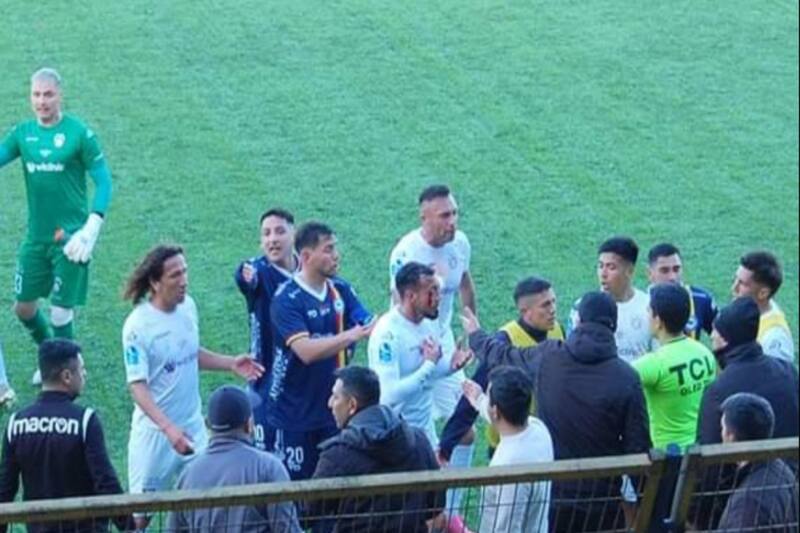 Roberto Cereceda terminó sangrando tras el codazo de Leonardo Ramos. (Foto: Radio Central Osorno)