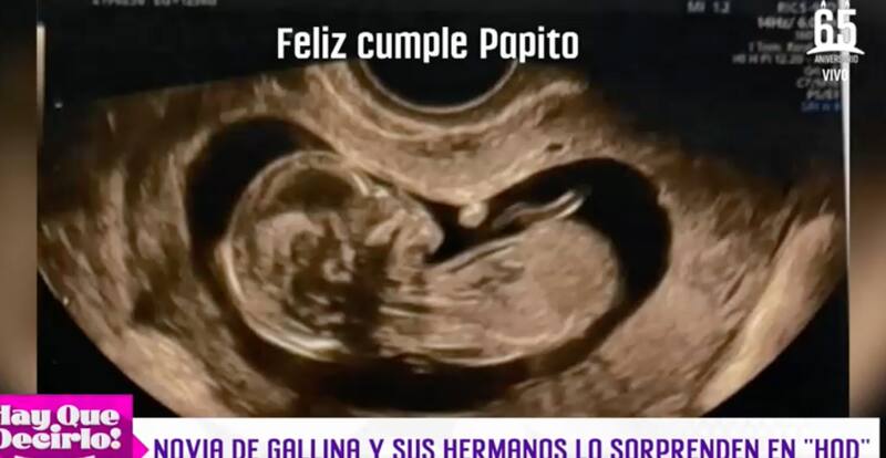 Rodrigo Gallina anunció que se convertirá en padre.