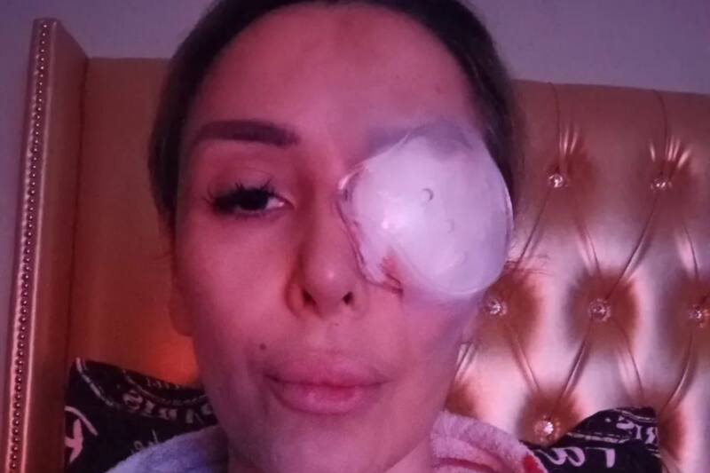 La ex "Mekano" recibió una brutal golpiza por parte de sus arrendatarios a principios del 2022.