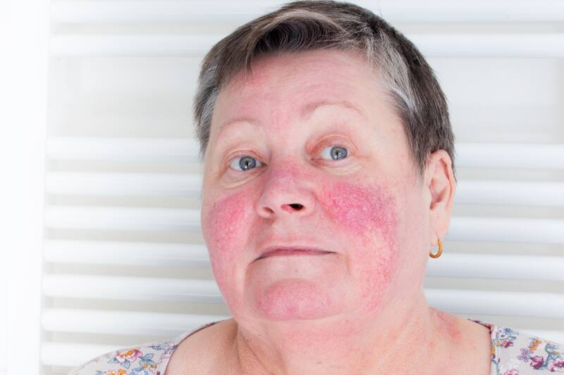 Conoce que aconsejan los especialistas.