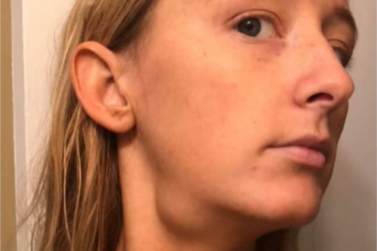 Mujer detecta cáncer gracias a rutina de belleza.