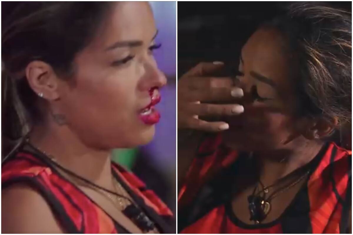 La participante sufrió un agrava accidente que la dejó fuera de competencia.