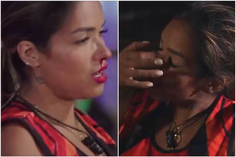 La participante sufrió un agrava accidente que la dejó fuera de competencia.