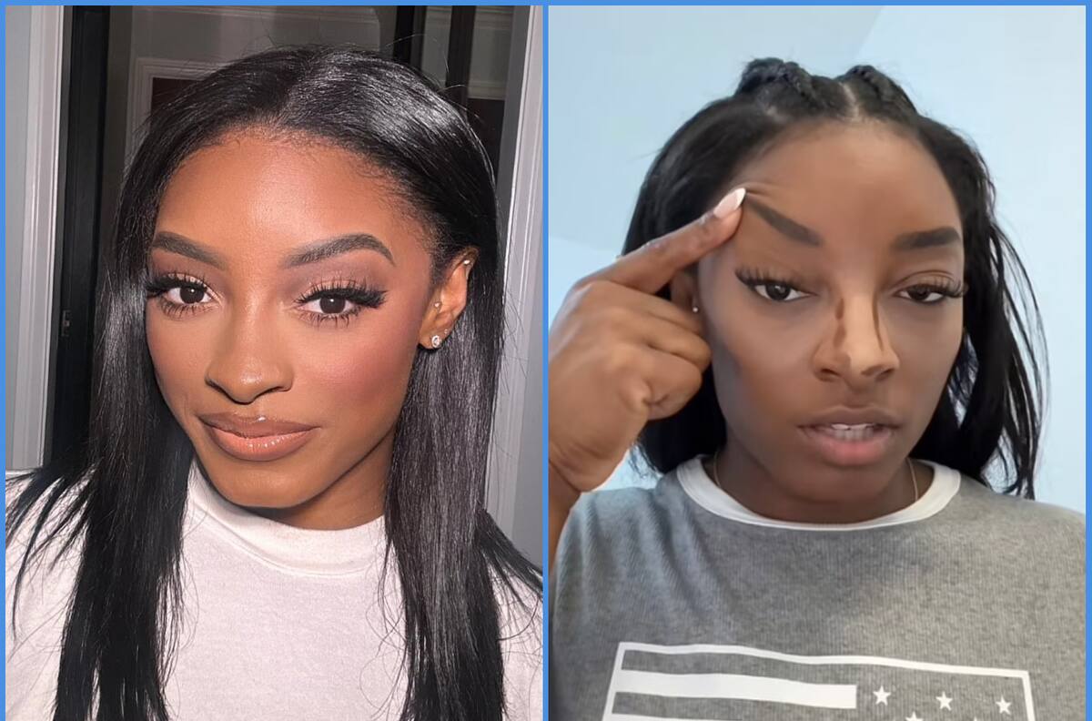 Simone Biles comparte su mala experiencia con el Botox: “No lo volveré a hacer”