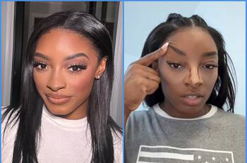 Simone Biles comparte su mala experiencia con el Botox: “No lo volveré a hacer”