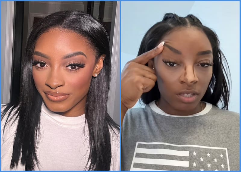 compartió su procedimiento estético en TikTok