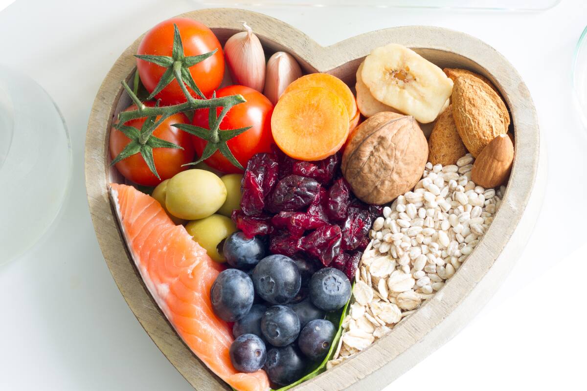 Este es el listado alimentos.