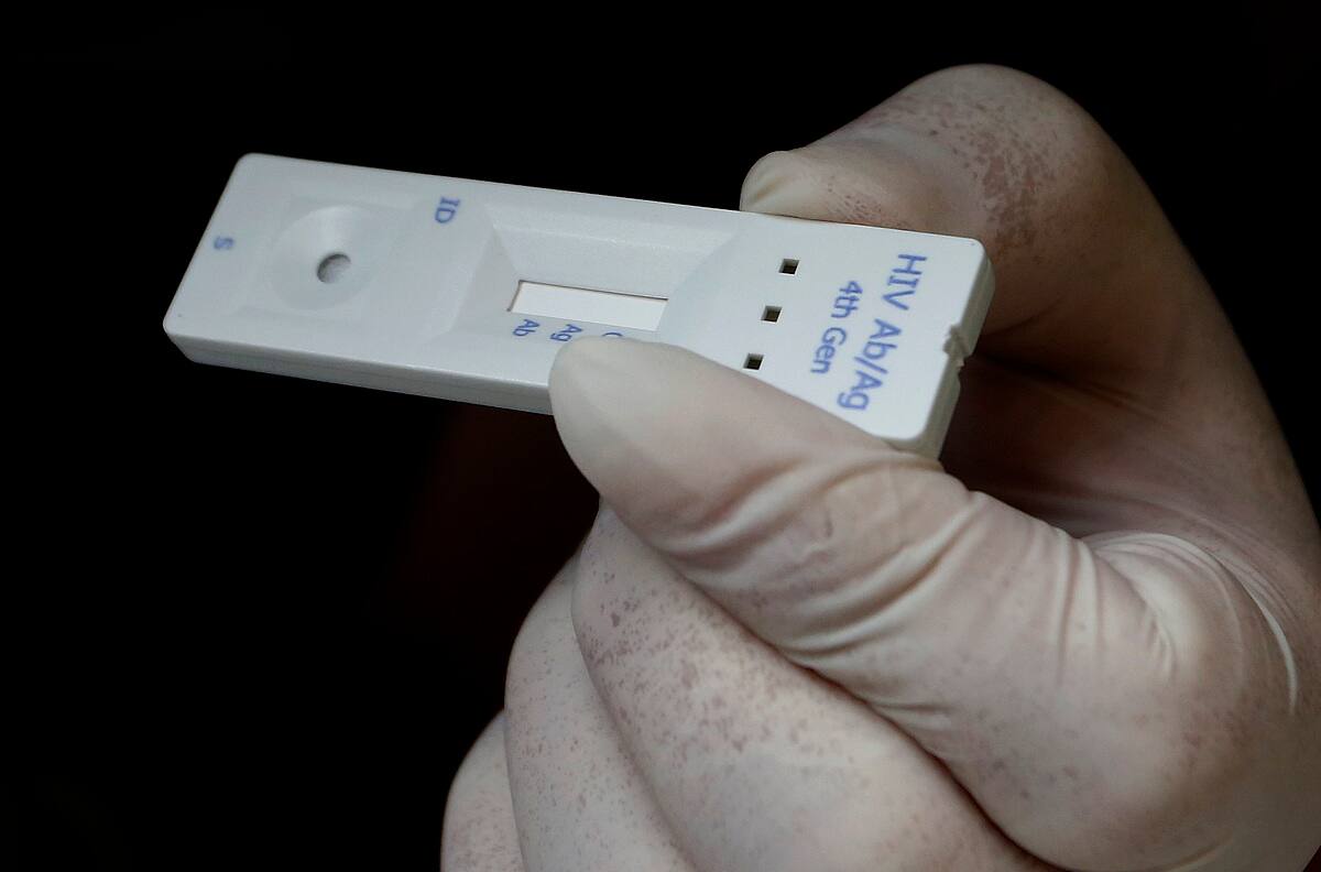 VIH: Conoce dónde puedes realizarte un test gratuito