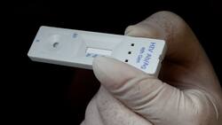 VIH: Conoce dónde puedes realizarte un test gratuito